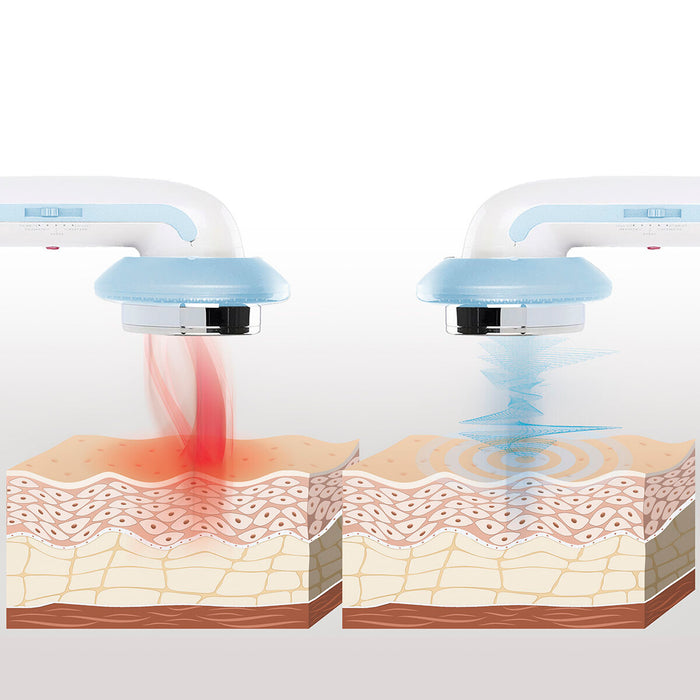 3-in-1 antiselluliitti ultraäänikavitaatio-hierontalaite infrapunalla ja elektrostimulaatiolla CellyMax InnovaGoods